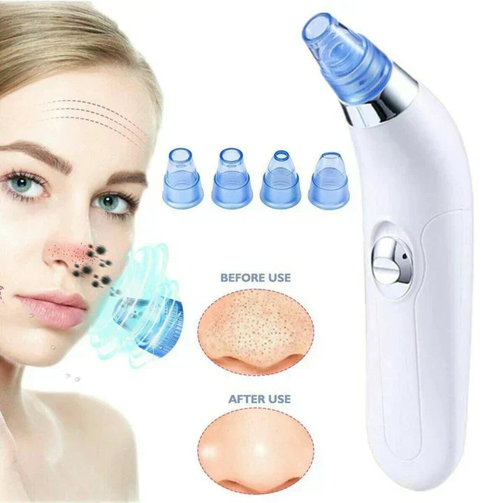 4 IN 1 Derma Suction Blackheads Remover